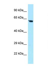 TBRG4 antibody LS-C146016 Western blot of Jurkat Cell lysate. Antibody concentration 1 ug/ml.