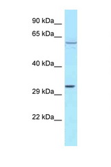 TBRG4 antibody LS-C146017 Western blot of MCF7 Cell lysate. Antibody concentration 1 ug/ml.