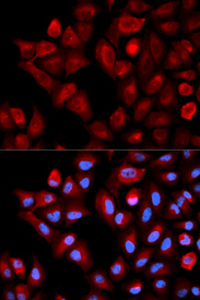 Immunofluorescence analysis of HeLa cell using TBRG4 antibody. Blue: DAPI for nuclear staining.