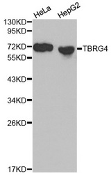 Western blot analysis of extracts of HeLa and HepG2 cells, using TBRG4 antibody.