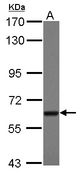 Sample (30 ug of whole cell lysate) A: A431 7.5% SDS PAGE TBRG4 antibody diluted at 1:1000