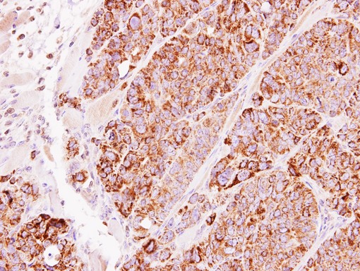 IHC of paraffin-embedded SW480 xenograft using TBRG4 antibody at 1:500 dilution.