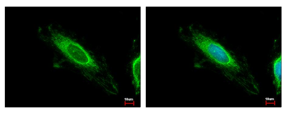 TBRG4 antibody detects TBRG4 protein at mitochondria by immunofluorescent analysis. HeLa cells were fixed in ice-cold MeOH for 5 min. TBRG4 protein stained by TBRG4 antibody diluted at 1:500. 