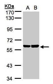 Sample (30 ug whole cell lysate). A: A431, B: Hep G2 . 7.5% SDS PAGE. TBRG4 antibody diluted at 1:1000