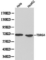 Western blot of TBRG4 pAb in extracts from Hela and HepG2 cells.