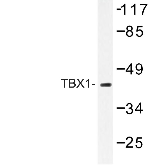 Western blot of TBX1 (K347) pAb in extracts from COLO 205 cells.