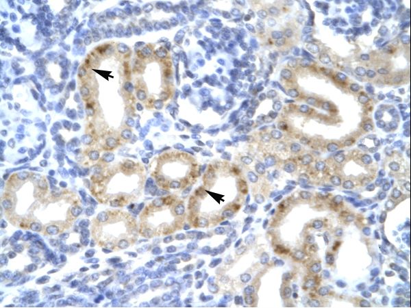 TBX1 antibody LS-C31179 was used in IHC to stain formalin-fixed, paraffin-embedded human kidney.