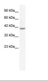 Jurkat Cell Lysate