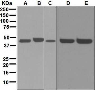 Western blot analysis on (A) PC-12, (B) F9, (C) Neuro-2a, (D) Jurkat, and (E) NCCIT cell lysates using anti-TBX1 antibody.