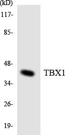 Western blot of the lysates from 293 cells using TBX1 antibody.