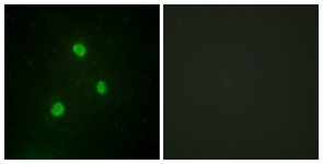 Immunofluorescence of A549 cells, using TBX1 Antibody. The picture on the right is treated with the synthesized peptide.