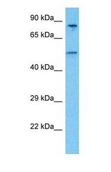 Western blot of TBX1 Antibody with human 786-0 Whole Cell lysate.