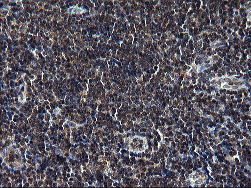 IHC of paraffin-embedded Human lymph node tissue using anti-TBX1 mouse monoclonal antibody. (Heat-induced epitope retrieval by 1 mM EDTA in 10mM Tris, pH8.5, 120°C for 3min).
