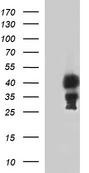 HEK293T cells were transfected with the pCMV6-ENTRY control (Left lane) or pCMV6-ENTRY TBX1 (Right lane) cDNA for 48 hrs and lysed. Equivalent amounts of cell lysates (5 ug per lane) were separated by SDS-PAGE and immunoblotted with anti-TBX1.