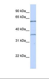 Jurkat cell lysate. Antibody concentration: 1.0 ug/ml. Gel concentration: 12%.