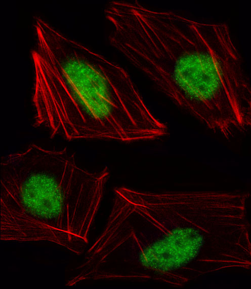 Fluorescent image of HUVEC cell stained with TBX15 Antibody. HUVEC cells were fixed with 4% PFA (20 min), permeabilized with Triton X-100 (0.1%, 10 min), then incubated with TBX15 primary antibody (1:25, 1 h at 37°C). For secondary antibody, Alexa Fluor 488 conjugated donkey anti-rabbit antibody (green) was used (1:400, 50 min at 37°C). Cytoplasmic actin was counterstained with Alexa Fluor 555 (red) conjugated Phalloidin (7units/ml, 1 h at 37°C). TBX15 immunoreactivity is localized to Nucleus significantly.