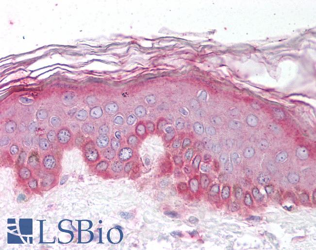 Anti-TBX15 antibody IHC of human skin. Immunohistochemistry of formalin-fixed, paraffin-embedded tissue after heat-induced antigen retrieval. Antibody LS-B908 concentration 10 ug/ml.