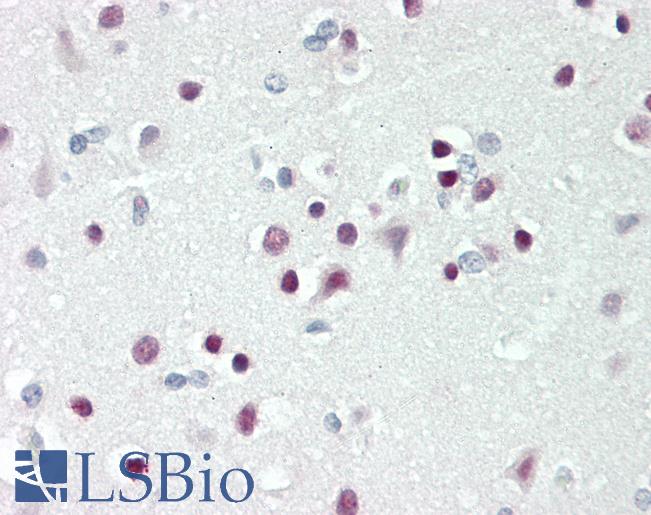 Human Brain, Cortex: Formalin-Fixed, Paraffin-Embedded (FFPE)