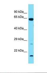 Western blot of Rat Lung. Tbx18 antibody dilution 1.0 ug/ml.