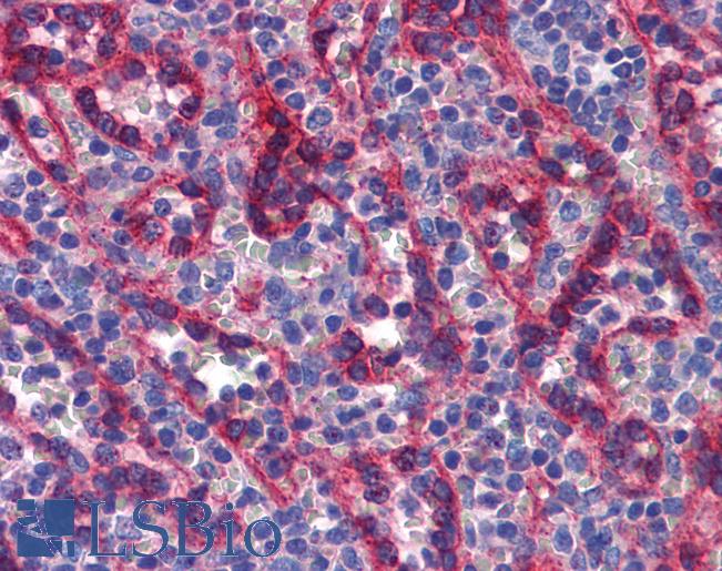 Anti-TBX18 antibody IHC of human spleen. Immunohistochemistry of formalin-fixed, paraffin-embedded tissue after heat-induced antigen retrieval. Antibody LS-B5621 concentration 5 ug/ml.