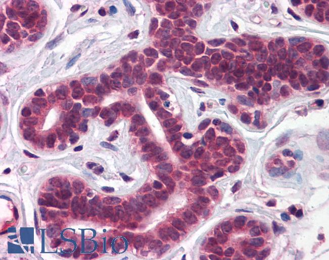 Anti-TBX18 antibody IHC of human breast. Immunohistochemistry of formalin-fixed, paraffin-embedded tissue after heat-induced antigen retrieval. Antibody LS-B5638 concentration 5 ug/ml.