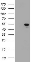 HEK293T cells were transfected with the pCMV6-ENTRY control (Left lane) or pCMV6-ENTRY TBX19 (Right lane) cDNA for 48 hrs and lysed. Equivalent amounts of cell lysates (5 ug per lane) were separated by SDS-PAGE and immunoblotted with anti-TBX19.