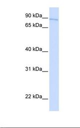 Fetal liver lysate. Antibody concentration: 1.0 ug/ml. Gel concentration: 12%.