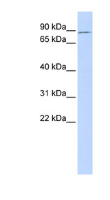TBX2 antibody LS-C109787 Western blot of Fetal Muscle lysate.