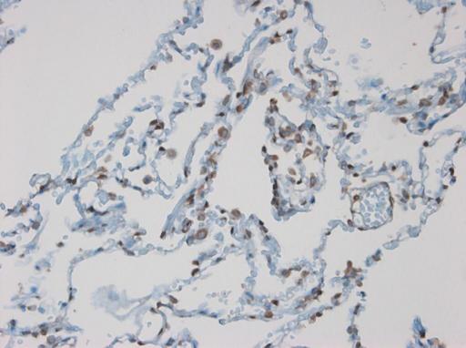 Immunohistochemistry on paraffin section of human lung