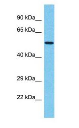 TBX20 antibody Western Blot of Jurkat. Antibody dilution: 1 ug/ml.