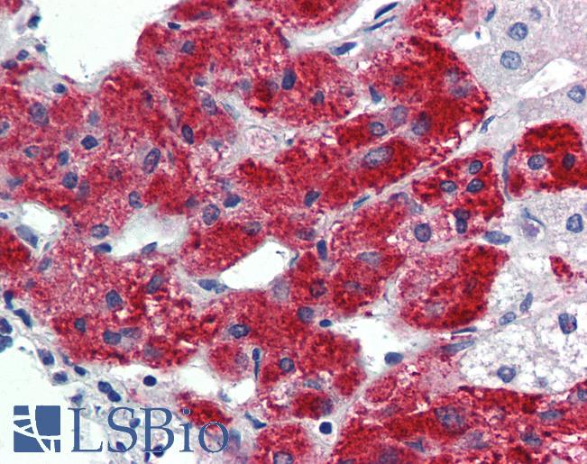 Anti-TBX20 antibody IHC of human adrenal. Immunohistochemistry of formalin-fixed, paraffin-embedded tissue after heat-induced antigen retrieval. Antibody LS-B3976 concentration 5 ug/ml.