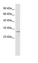 HepG2 Cell Lysate.