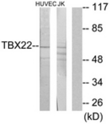 Western blot of extracts from Jurkat/HUVEC cells, using TBX22 Antibody. The lane on the right is treated with the synthesized peptide.