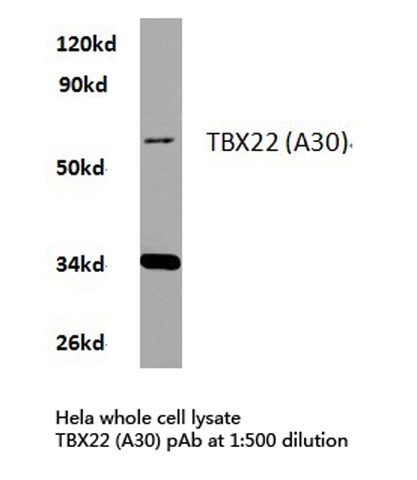 Western blot of TBX22 (A30) pAb in extracts from HeLa cells.