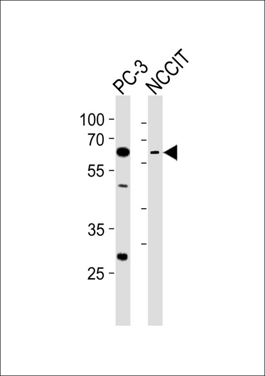 Western blot of lysates from PC-3, NCCIT cell line (from left to right) with TBX22 Antibody. Antibody was diluted at 1:1000 at each lane. A goat anti-rabbit IgG H&L (HRP) at 1:10000 dilution was used as the secondary antibody. Lysates at 35 ug per lane.