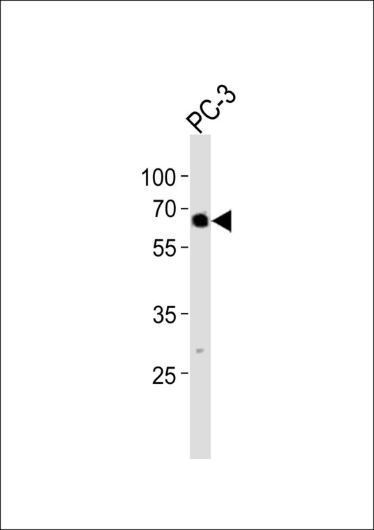Western blot of lysate from PC-3 cell line with TBX22 Antibody. Antibody was diluted at 1:1000. A goat anti-rabbit IgG H&L (HRP) at 1:10000 dilution was used as the secondary antibody. Lysate at 20 ug.