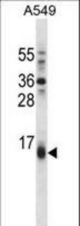BBC3 Antibody western blot of A549 cell line lysates (35 ug/lane). The BBC3 antibody detected the BBC3 protein (arrow).