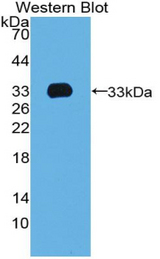 Western blot of recombinant TBX4.