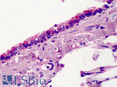Anti-TBX4 antibody IHC of human lung. Immunohistochemistry of formalin-fixed, paraffin-embedded tissue after heat-induced antigen retrieval. Antibody LS-B910 concentration 5 ug/ml.