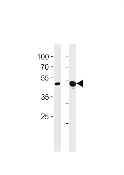 TBX4 Antibody western blot of A549,mouse NIH/3T3 cell line lysates (35 ug/lane). The TBX4 antibody detected the TBX4 protein (arrow).
