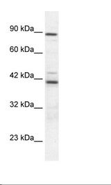 Jurkat Cell Lysate