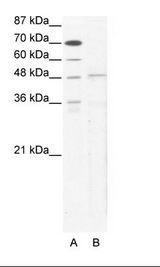 A: Marker, B: HepG2 Cell Lysate