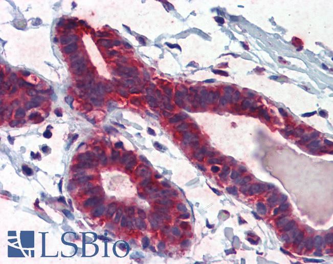 Anti-TBX5 antibody IHC of human breast. Immunohistochemistry of formalin-fixed, paraffin-embedded tissue after heat-induced antigen retrieval. Antibody LS-B3503 concentration 5 ug/ml.