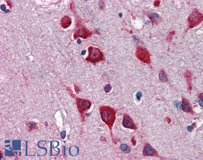 Anti-TBX5 antibody IHC of human brain, cortex. Immunohistochemistry of formalin-fixed, paraffin-embedded tissue after heat-induced antigen retrieval. Antibody LS-B3503 concentration 5 ug/ml.