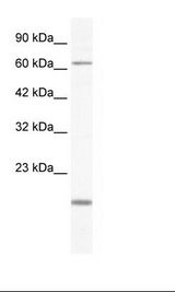 Jurkat Cell Lysate.