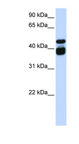 TBX6 antibody LS-C112151 Western blot of Fetal Brain lysate.