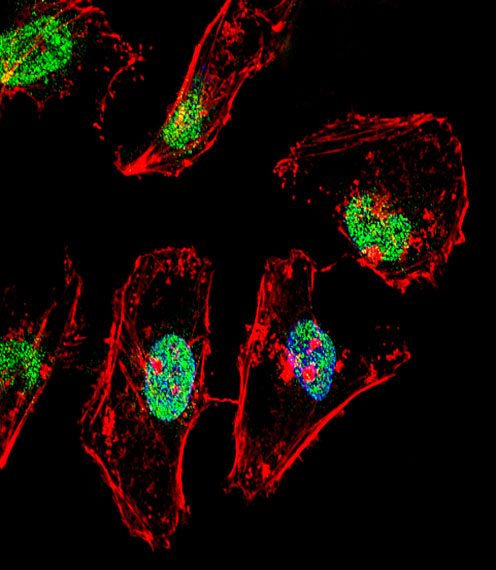 Fluorescent confocal image of HeLa cell stained with TBX6 Antibody. HeLa cells were fixed with 4% PFA (20 min), permeabilized with Triton X-100 (0.1%, 10 min), then incubated with TBX6 primary antibody (1:25, 1 h at 37°C). For secondary antibody, Alexa Fluor 488 conjugated donkey anti-rabbit antibody (green) was used (1:400, 50 min at 37°C). Cytoplasmic actin was counterstained with Alexa Fluor 555 (red) conjugated Phalloidin (7units/ml, 1 h at 37°C). Nuclei were counterstained with DAPI (blue) (10 ug/ml, 10 min). TBX6 immunoreactivity is localized to nucleus significantly.