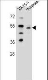 TBX6 Antibody western blot of ZR-75-1 cell line and mouse spleen tissue lysates (35 ug/lane). The TBX6 antibody detected the TBX6 protein (arrow).
