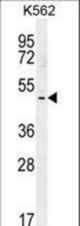 TBX6 Antibody western blot of K562 cell line lysates (35 ug/lane). The TBX6 antibody detected the TBX6 protein (arrow).