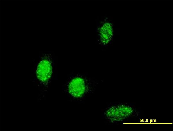 Immunofluorescence of monoclonal antibody to TBX6 on HeLa cell . [antibody concentration 10 ug/ml]